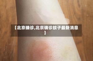 【北京确诊,北京确诊蚊子最新消息】