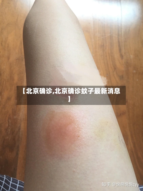【北京确诊,北京确诊蚊子最新消息】-第1张图片