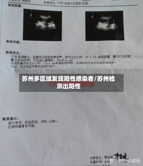 苏州多区域发现阳性感染者/苏州检测出阳性-第1张图片